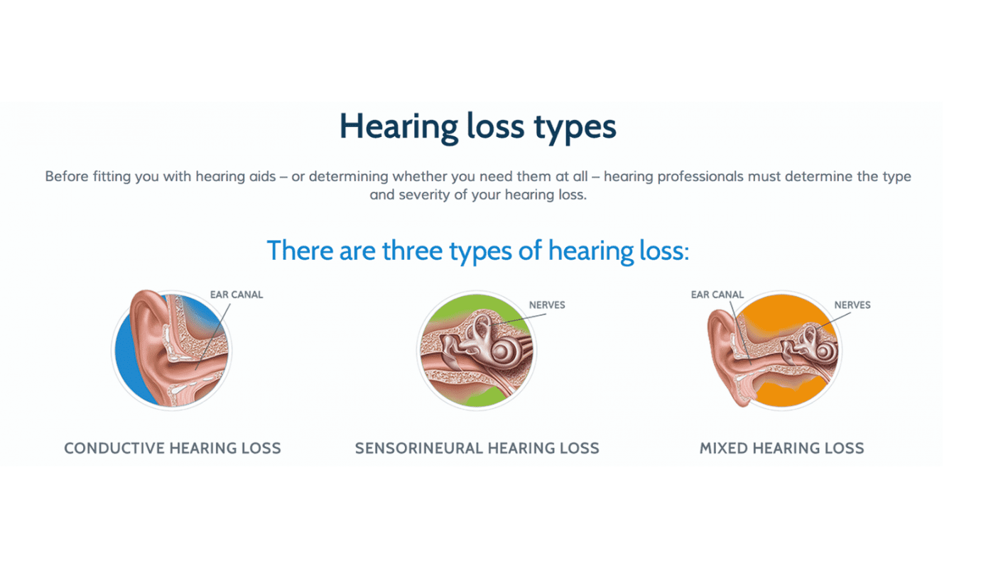 hearing loss type