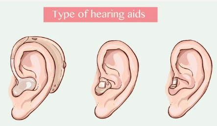 Types of hearing aid