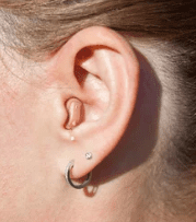 In-The-Ear Hearing Aid