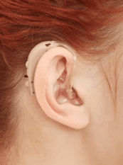 Behind-The-Ear hearing aid