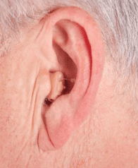 canal hearing aid