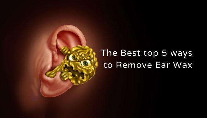 Remove Ear Wax